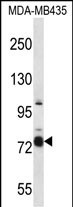 Rabbit Polyclonal Antibody to CASS4