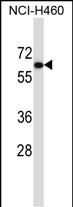 Rabbit Polyclonal Antibody to UGT2B11