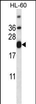 Rabbit Polyclonal Antibody to CD3E