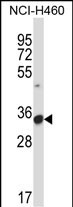 Rabbit Polyclonal Antibody to FCGR3A
