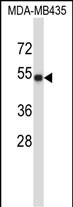 Rabbit Polyclonal Antibody to TUBA3C