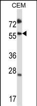 Rabbit Polyclonal Antibody to SMAD3