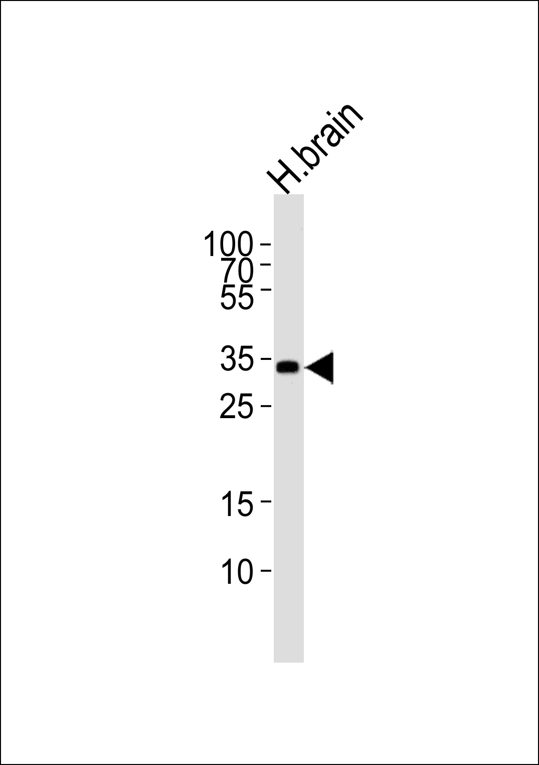 Rabbit Polyclonal Antibody to STMN4 (N-term)