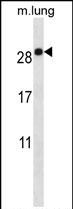 Rabbit Polyclonal Antibody to EMP2