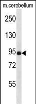 Rabbit Polyclonal Antibody to NSMAF (N-term)