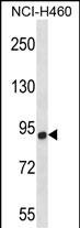 Rabbit Polyclonal Antibody to CHSY1