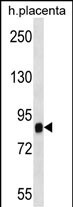 Rabbit Polyclonal Antibody to SIDT2