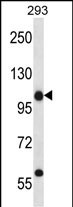 Rabbit Polyclonal Antibody to C14orf135