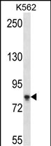 Rabbit Polyclonal Antibody to SAMD4B