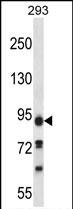 Rabbit Polyclonal Antibody to KIAA1274