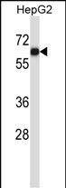 Rabbit Polyclonal Antibody to AMIGO1
