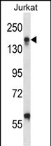 Rabbit Polyclonal Antibody to ITGAL