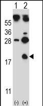Rabbit Polyclonal Antibody to HBG1