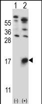 Rabbit Polyclonal Antibody to GYPB