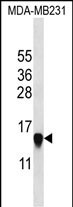 Rabbit Polyclonal Antibody to HIST2H2AA3 (N-term)