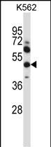Rabbit Polyclonal Antibody to MMP13