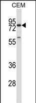 Rabbit Polyclonal Antibody to MMP16