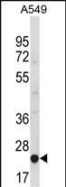 Rabbit Polyclonal Antibody to MBL2