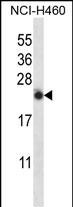 Rabbit Polyclonal Antibody to IL13