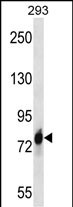 Rabbit Polyclonal Antibody to CDH16