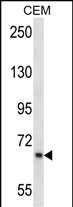 Rabbit Polyclonal Antibody to SILV