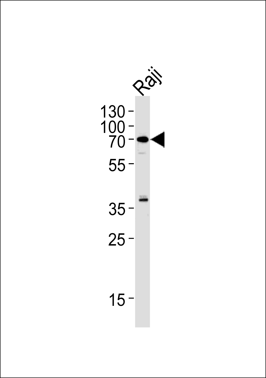 Rabbit Polyclonal Antibody to RIPK2 (N-term)