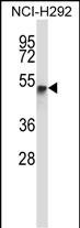 Rabbit Polyclonal Antibody to RANBP3L