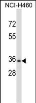 Rabbit Polyclonal Antibody to CELA3B (N-term)