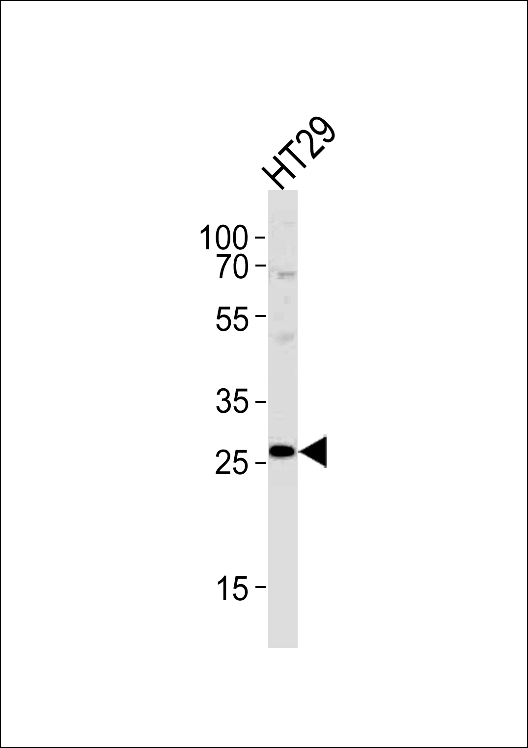 Rabbit Polyclonal Antibody to NNMT
