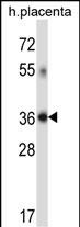 Rabbit Polyclonal Antibody to DHRS7C