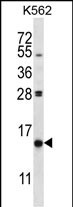 Rabbit Polyclonal Antibody to PIK3IP1