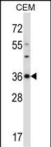 Rabbit Polyclonal Antibody to Mouse Cdk3