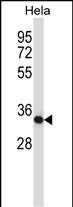 Rabbit Polyclonal Antibody to Mouse Csnk2a2 (N-term)