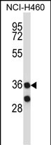 Rabbit Polyclonal Antibody to MARCH11