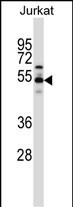 Rabbit Polyclonal Antibody to VPS4B