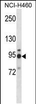 Rabbit Polyclonal Antibody to MGAT5