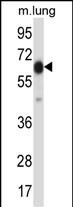 Rabbit Polyclonal Antibody to POF1B