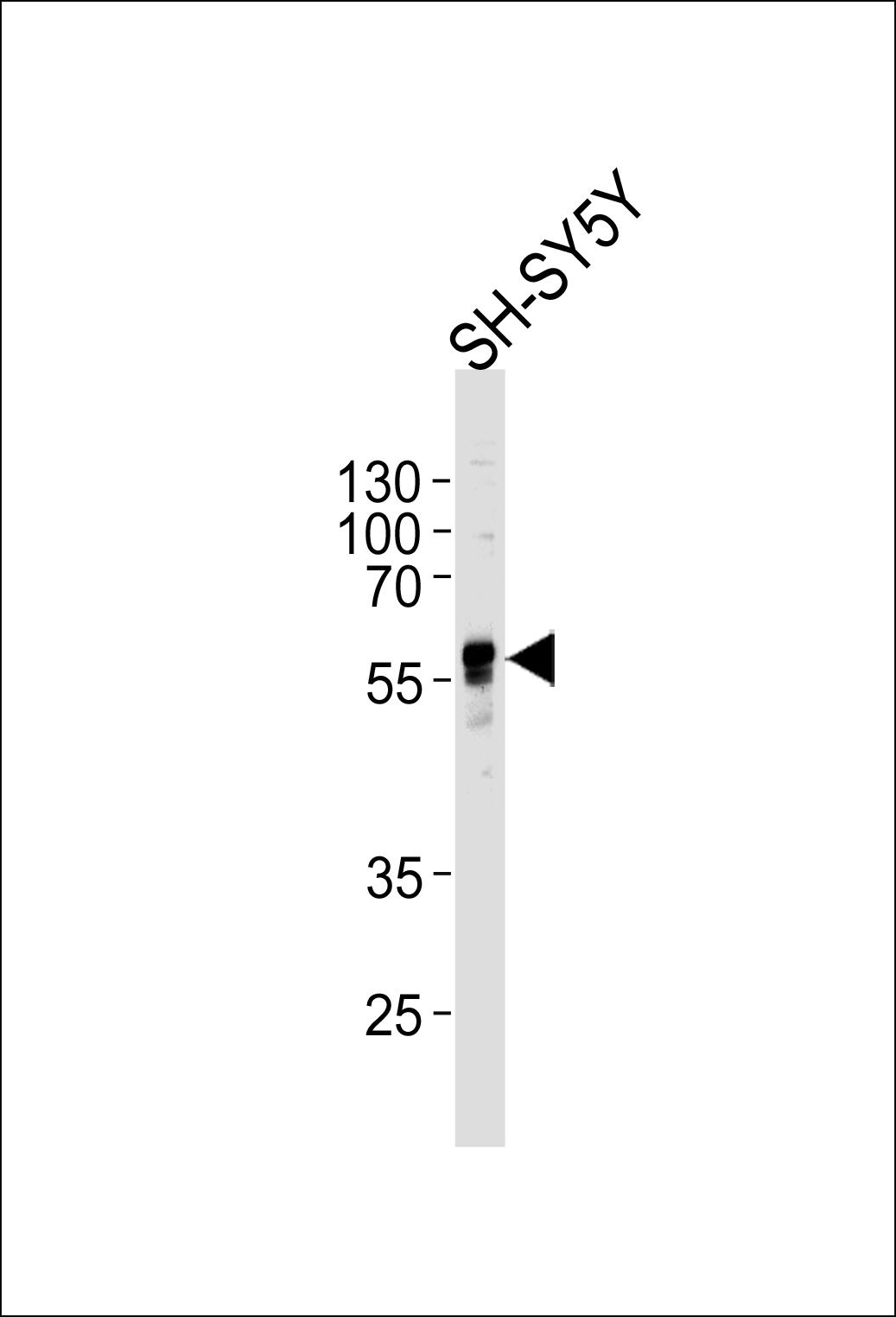 Rabbit Polyclonal Antibody to ABHD3