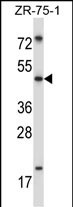 Rabbit Polyclonal Antibody to MDM4