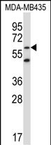 Rabbit Polyclonal Antibody to ZNF479 (N-term)