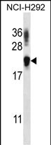Rabbit Polyclonal Antibody to TTC33