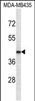 Mouse Monoclonal Antibody to LHX2