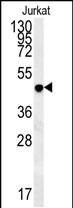 Rabbit Polyclonal Antibody to DAO