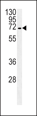 Rabbit Polyclonal Antibody to SLC22A1