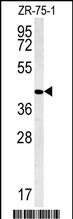 Rabbit Polyclonal Antibody to PPAN