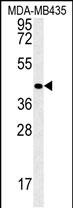 Rabbit Polyclonal Antibody to VASH2