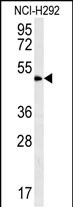 Rabbit Polyclonal Antibody to ZNF154 (N-term)
