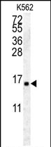 Rabbit Polyclonal Antibody to HIST2H2AA4