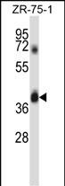 Rabbit Polyclonal Antibody to DPAGT1 (N-term)
