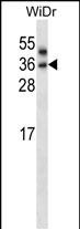 Rabbit Polyclonal Antibody to PNPLA4